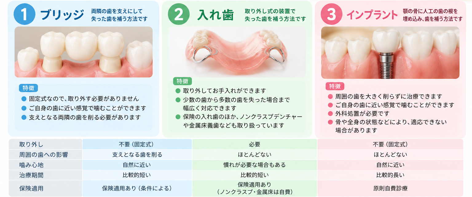 入れ歯・欠損治療の写真(岩手県大槌町)